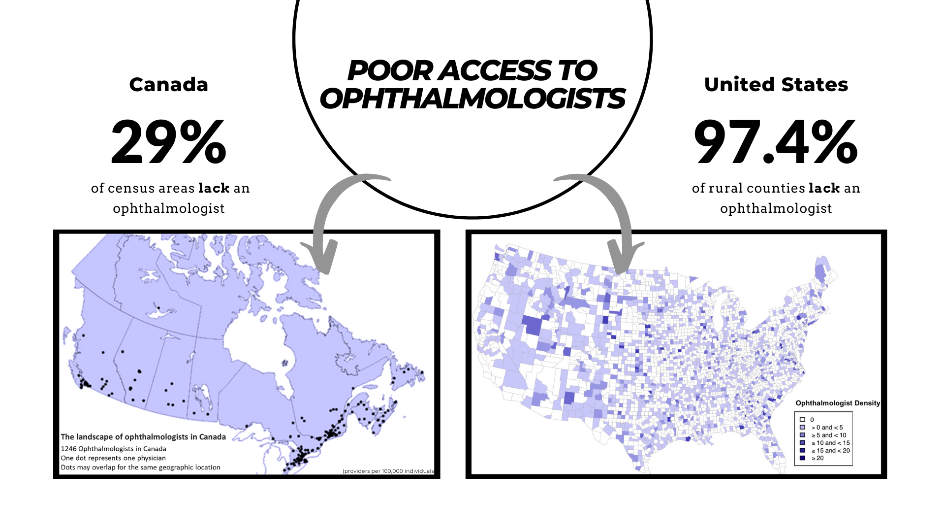 In Canada, 29% of census areas lack an opthalmologist. In the United States, 97.4% of rural counties lack an opthalmologist 
